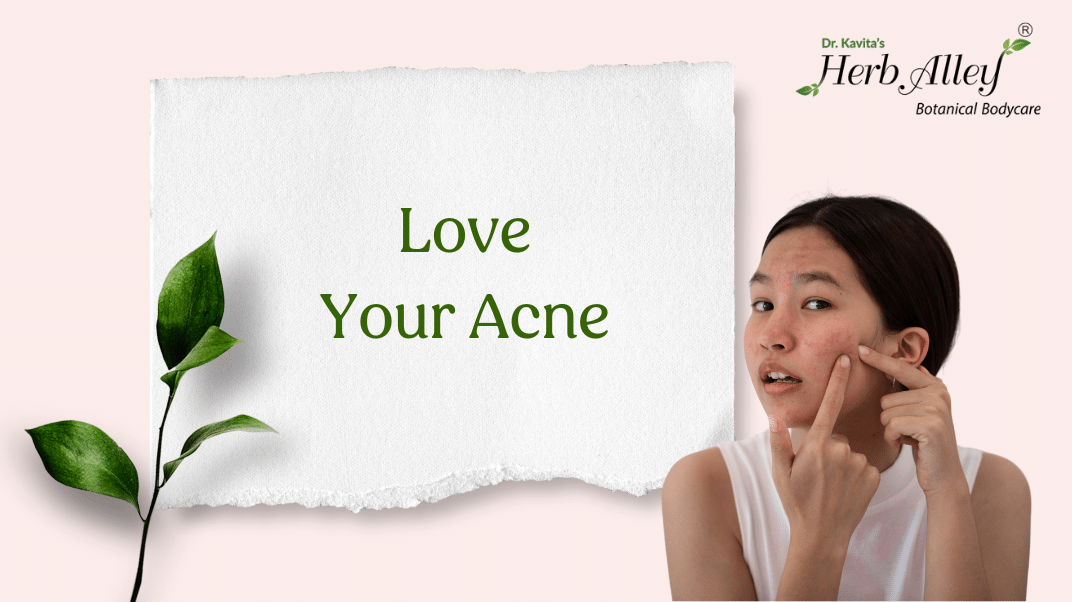 Love Your Acne
